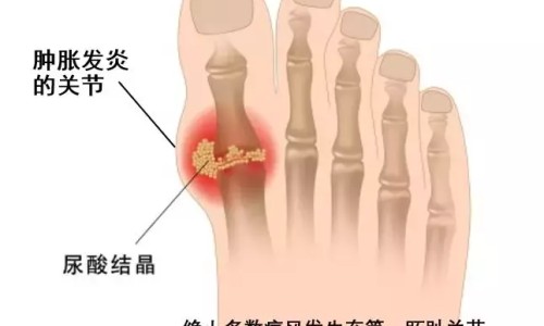 盐酸左氧氟沙星能治肠炎吗-盐酸左氧氟沙星片的功能主治网盐酸左氧氟沙星治疗前列腺炎知识网站,分享盐酸左氧氟沙星片的功能主治是什么大全
